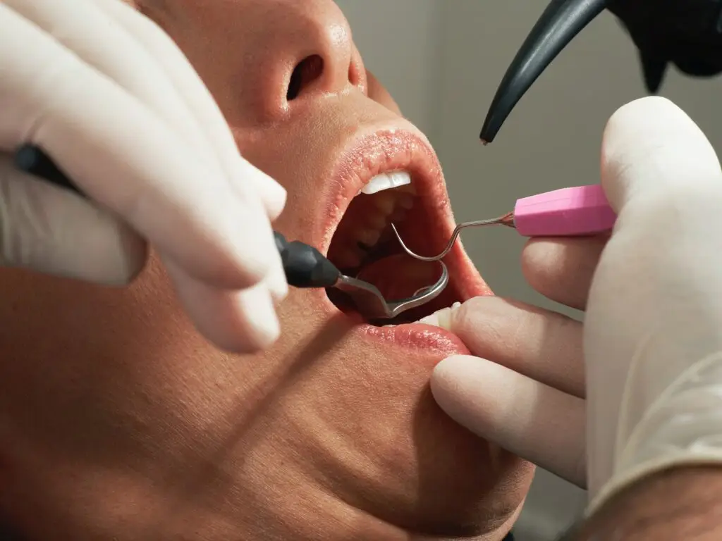 Zbliżenie otwartych ust osoby podczas badania stomatologicznego, z rękami w rękawiczkach używającymi narzędzi dentystycznych do sprawdzania i czyszczenia zębów - prawdopodobnie przygotowujących się do wyrwania zęba.