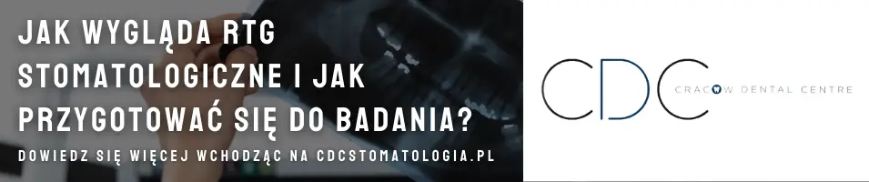 jak wygląda rtg stomatologiczne