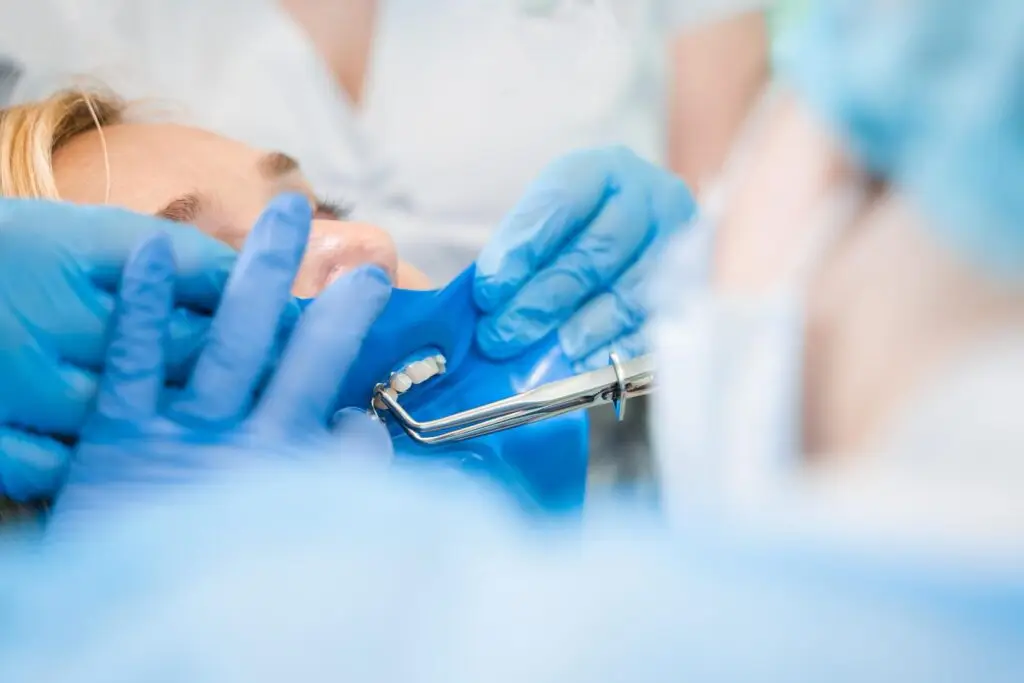 Zbliżenie na pacjenta na fotelu dentystycznym z niebieskim koferdamem w ustach, otoczonego rękami w rękawiczkach wykonujących zabieg dentystów.