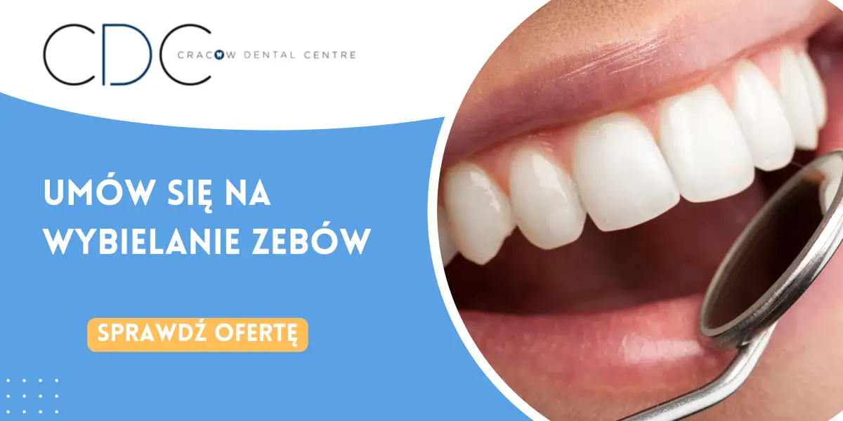 baner wybielanie zębów CDC Stomatologia