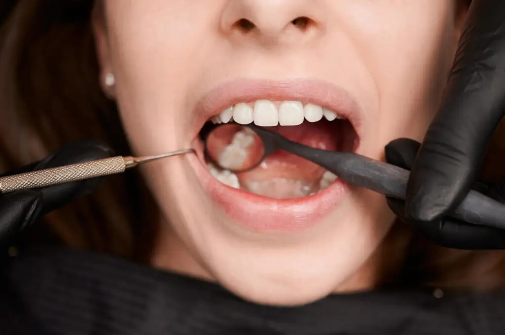 Zbliżenie osoby z otwartymi ustami podczas badania stomatologicznego, gdy dentysta używa rąk w rękawiczkach i narzędzi dentystycznych do sprawdzenia zębów.